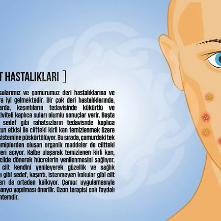 Basaranlar Thermal Ξενοδοχείο με διαμερίσματα