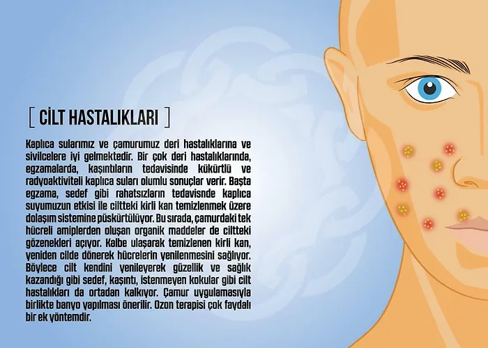 Basaranlar Thermal Apart-hotel